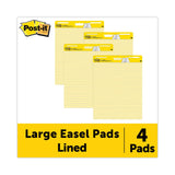 3M Post-it Vertical-Orientation Self-Stick Easel Pad Value Pack, Presentation Format (1.5" Rule), 25 x 30, Yellow, 30 Sheets, 4/Carton - Dependable Expendables